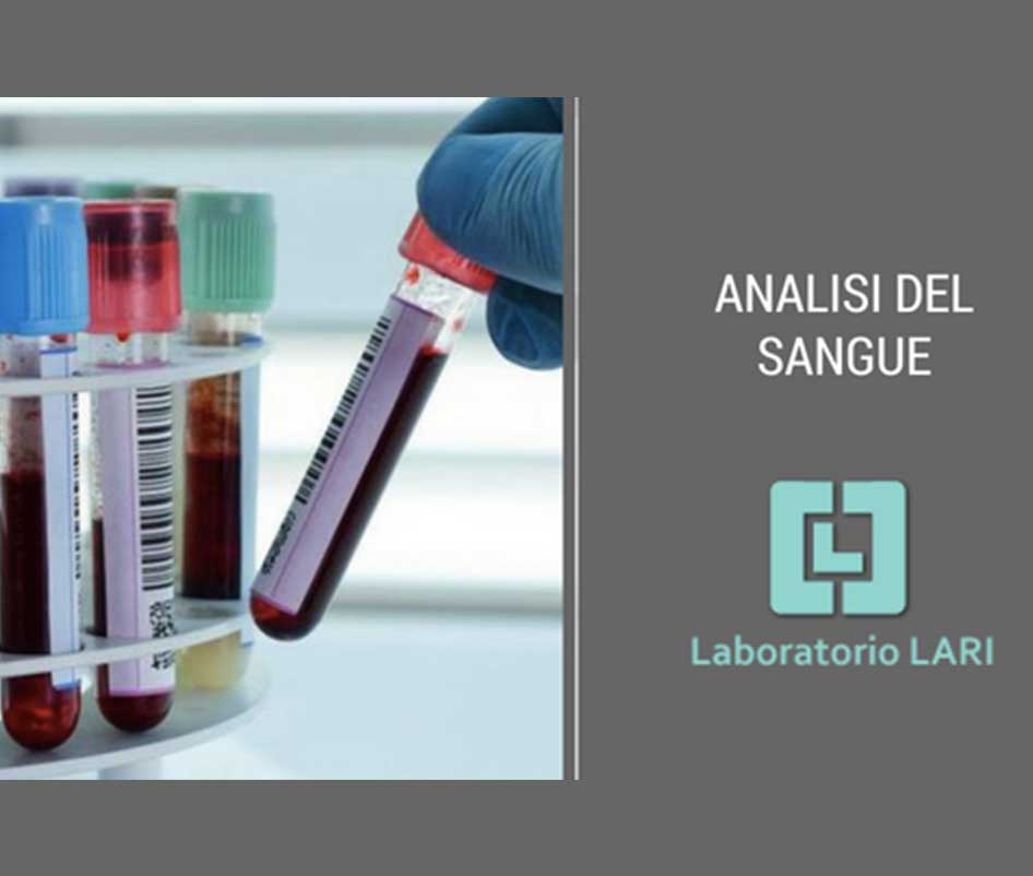 https://www.laboratoriolari.it/wp-content/uploads/2021/03/analisi.jpg